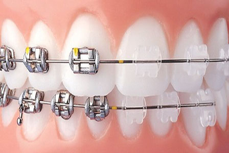 Dentalsancak Ortodonti